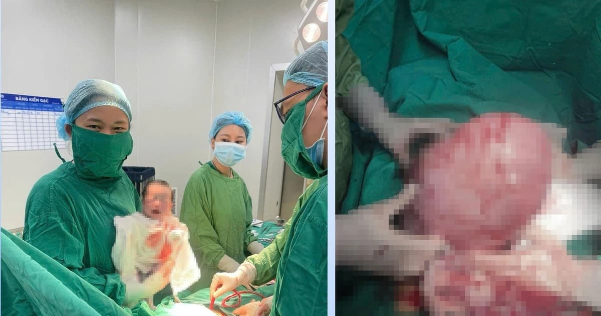 Xử lý thành công khối u xơ tử cung nặng 1,6kg và đón bé trai chào đời